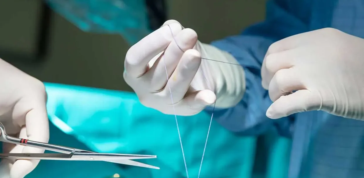 Dissolvable Stitches