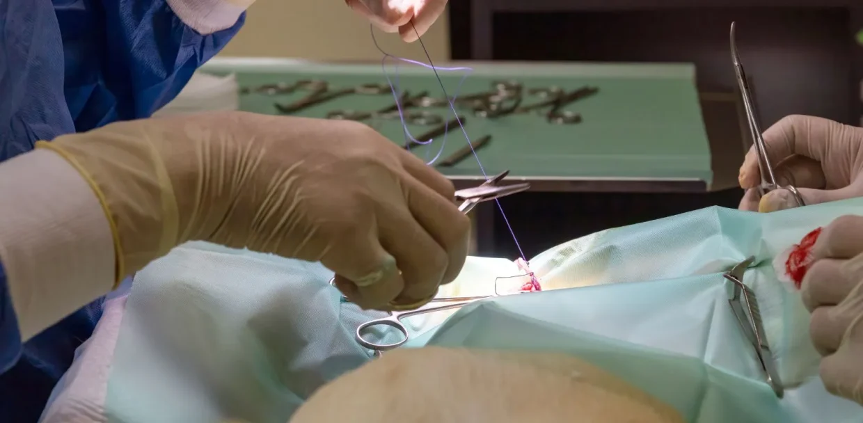 Types of Veterinary Surgical Sutures